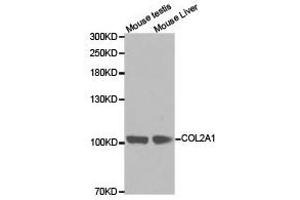Western Blotting (WB) image for anti-Collagen, Type II, alpha 1 (COL2A1) antibody (ABIN1871948) (COL2A1 antibody)