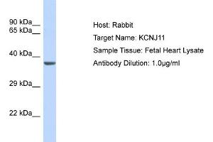 Host: Rabbit Target Name: KCNJ11 Sample Type: Fetal Heart lysates Antibody Dilution: 1.