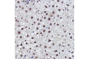 Immunohistochemistry of paraffin-embedded rat liver using MED4 Rabbit mAb (ABIN7268445) at dilution of 1:100 (40x lens).