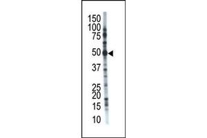 Image no. 1 for anti-Ubiquitin Specific Peptidase 12 (USP12) (C-Term) antibody (ABIN357543) (USP12 antibody  (C-Term))