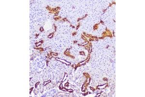 IHC analysis of Calbindin using anti-Calbindin antibody (ABIN6719541). (CALB1 antibody  (AA 2-261))