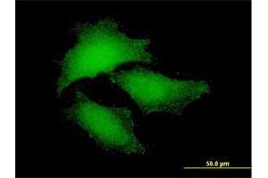 Immunofluorescence of purified MaxPab antibody to NF2 on HeLa cell. (Merlin antibody  (AA 1-507))