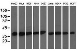 Image no. 1 for anti-DnaJ (Hsp40) Homolog, Subfamily A, Member 2 (DNAJA2) antibody (ABIN1497861) (DNAJA2 antibody)