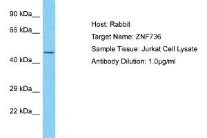 Host: Rabbit Target Name: ZNF736 Sample Type: Jurkat Whole Cell lysates Antibody Dilution: 1. (ZNF736 antibody  (N-Term))