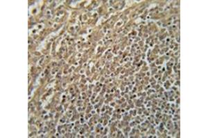 Immunohistochemistry analysis in human spleen tissue (Formalin-fixed, Paraffin-embedded) using RASAL3  Antibody (C-term), followed by peroxidase conjugated secondary antibody and DAB staining. (RASAL3 antibody  (C-Term))