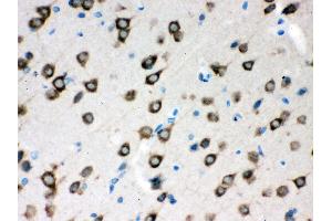 Anti- SMN1/2 Picoband antibody,IHC(P) IHC(P): Rat Brain Tissue (SMN1 / SMN2 (AA 22-52), (N-Term) antibody)