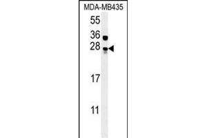MUTED Antibody (Center) (ABIN654098 and ABIN2843982) western blot analysis in MDA-M cell line lysates (15 μg/lane). (MUTED antibody  (AA 40-68))