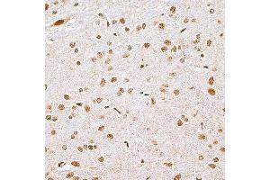 Immunohistochemistry of paraffin-embedded rat brain using CBX6 antibody (ABIN6127558, ABIN6138026, ABIN6138027 and ABIN6221185) at dilution of 1:100 (40x lens). (CBX6 antibody  (AA 80-180))