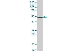 EIF4A2 polyclonal antibody (A01), Lot # 060112JC01 Western Blot analysis of EIF4A2 expression in Jurkat . (EIF4A2 antibody  (AA 1-100))