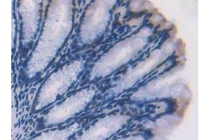 Detection of ADK in Mouse Colon Tissue using Polyclonal Antibody to Adenosine Kinase (ADK)