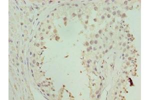 Immunohistochemistry of paraffin-embedded human testis tissue using ABIN7176343 at dilution of 1:100 (ZNF546 antibody  (AA 101-400))