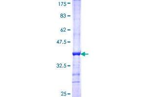 RNPEP Protein (AA 551-650) (GST tag)