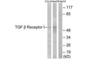 Western blot analysis of extracts from COLO cells and HepG2 cells, using TGF β Receptor I (Ab-165) antibody. (TGFBR1 antibody  (Ser165))