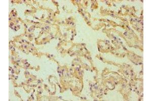 Immunohistochemistry of paraffin-embedded human lung tissue using ABIN7167766 at dilution of 1:100 (ALDH1A2 antibody  (AA 1-180))