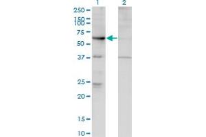 Western Blot analysis of ARHGEF5 expression in transfected 293T cell line by ARHGEF5 monoclonal antibody (M02), clone 4D10-D11. (ARHGEF5 antibody  (AA 1-519))