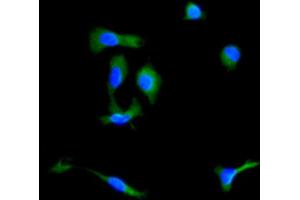Immunocytochemistry analysis of Mouse MSC cells using Ly-6G Antibody.