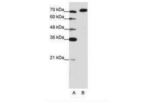 Image no. 3 for anti-A Kinase (PRKA) Anchor Protein 8-Like (AKAP8L) (C-Term) antibody (ABIN202849) (AKAP8L antibody  (C-Term))
