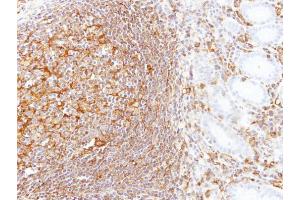 IHC-P Image Immunohistochemical analysis of paraffin-embedded human gastric N+T, using LBP, antibody at 1:100 dilution. (LBP antibody)