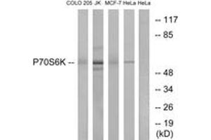 Western blot analysis of extracts from COLO205/Jurkat/MCF-7/HeLa cells, using p70 S6 Kinase (Ab-418) Antibody. (RPS6KB1 antibody  (AA 384-433))