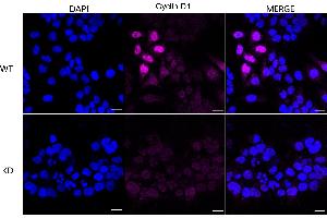 Immunocytochemical staining of HeLa cells using Cyclin D1 antibody (ABIN7798194), 1:1,000), Top panel: wild-type (WT), Bottom panal: Cyclin D1 shRNA knockdown (KD). (Recombinant Cyclin D1 antibody)