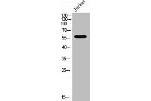 Western Blot analysis of JK cells using Phospho-4. (EPB41 antibody  (pTyr660))