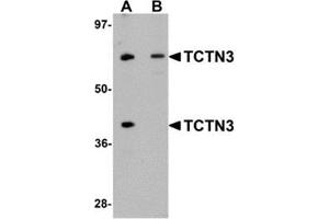 Western blot analysis of TCTN3 in HeLa cell lysate with TCTN3 antibody at (A) 1 and (B) 2 μg/ml.