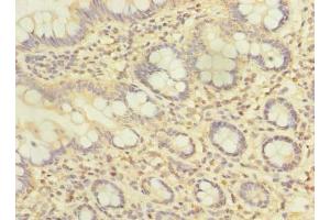 Immunohistochemistry of paraffin-embedded human small intestine tissue using ABIN7144056 at dilution of 1:100 (ZFAND2A antibody  (AA 1-145))