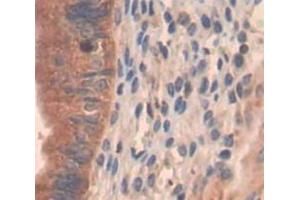 IHC-P analysis of Kidney tissue, with DAB staining. (PI4KA antibody  (AA 1-300))