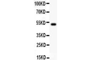Anti- IL18 Picoband antibody, Western blotting All lanes: Anti IL18  at 0.