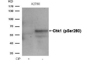 Western blot analysis of extracts from A2780 cells, treated with calf intestinal phosphatase (CIP), using Chk1 (Phospho-Ser280) Antibody. (CHEK1 antibody  (pSer280))