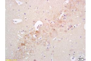 Formalin-fixed and paraffin embedded rat brain labeled with Rabbit Anti phospho-IRAK4(Thr345)Polyclonal Antibody, Unconjugated (ABIN753538) at 1:200 followed by conjugation to the secondary antibody and DAB staining
