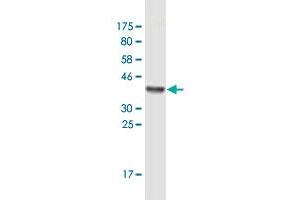 Western Blot detection against Immunogen (36. (Exportin 2 antibody  (AA 872-971))
