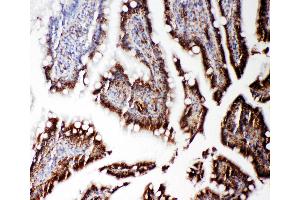 Anti-RGS3 antibody, IHC(P) IHC(P): Rat Intestine Tissue (RGS3 antibody  (C-Term))