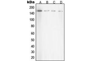 Western blot analysis of ROCK1 expression in HeLa (A), NIH3T3 (B), C6 (C), COS7 (D) whole cell lysates. (ROCK1 antibody  (Center))