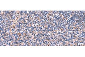 Immunohistochemistry of paraffin-embedded Human tonsil tissue using MPP1 Polyclonal Antibody at dilution of 1:50(x200) (MPP1 antibody)