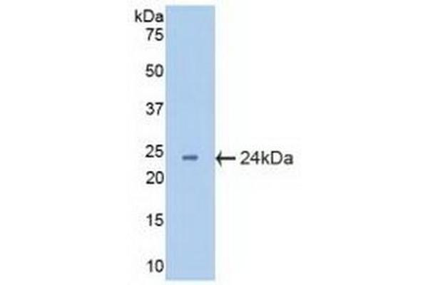 CRYbB2 antibody  (AA 17-191)