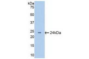 Detection of Recombinant CRYbB2, Mouse using Polyclonal Antibody to Crystallin Beta B2 (CRYbB2) (CRYbB2 antibody  (AA 17-191))