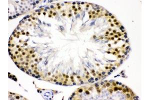 IHC testing of FFPE rat testis with Cdk2 antibody. (CDK2 antibody  (AA 81-298))
