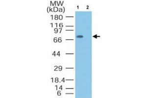 Western blot analysis of MTA2 in Jurkat lysate in the 1) absence and 2) presence of immunizing peptide. (MTA2 antibody  (AA 650-700))