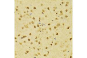 Immunohistochemistry of paraffin-embedded Rat brain using RBFOX3 antibody at dilution of 1:100 (x400 lens). (NeuN antibody)