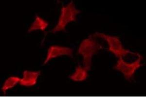ABIN6275880 staining NIH-3T3 by IF/ICC. (KLRK1 antibody  (Internal Region))