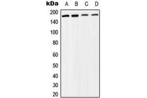Western blot analysis of BAF170 expression in Raji (A), MCF7 (B), mouse liver (C), rat liver (D) whole cell lysates. (SMARCC2 antibody  (Center))