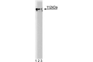 Western Blotting (WB) image for anti-Adaptor-Related Protein Complex 2, alpha 1 Subunit (AP2A1) (AA 38-215) antibody (ABIN968009) (alpha Adaptin antibody  (AA 38-215))