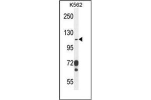 Western blot analysis of CD103 Antibody (C-term) in K562 cell line lysates (35ug/lane).