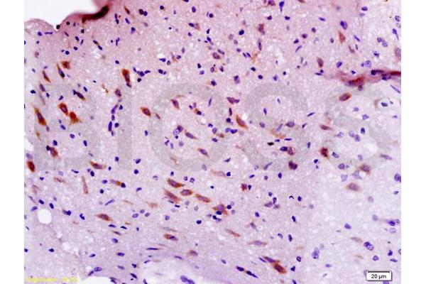 SEMA3F antibody  (AA 651-754)