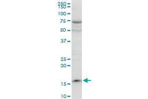 PPIL1 polyclonal antibody (A01), Lot # 060524JCS1. (PPIL1 antibody  (AA 76-166))