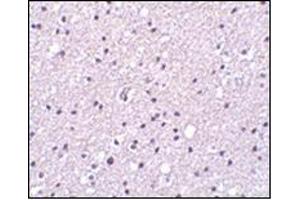 Immunohistochemistry of Neurotrypsin in human brain tissue with this product at 2. (Neurotrypsin antibody  (N-Term))