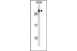 Western blot analysis of RGS5 Antibody (N-term) in CEM cell line lysates (35ug/lane). (RGS5 antibody  (N-Term))