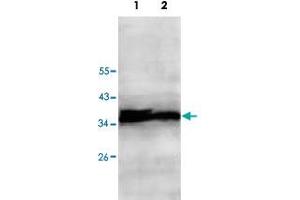 Western blot analysis of HepG2 (Lane 1) and Jurkat (Lane 2) cell lysate with ECH1 polyclonal antibody  at 1 : 500 dilution. (ECH1 antibody  (AA 145-325))