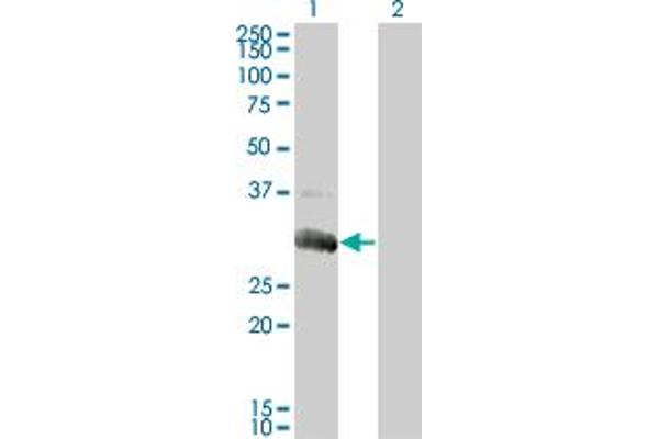 Deoxyguanosine Kinase antibody  (AA 1-89)